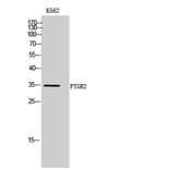 Western Blot - Anti-ZADH1 Antibody (C19633) - Antibodies.com