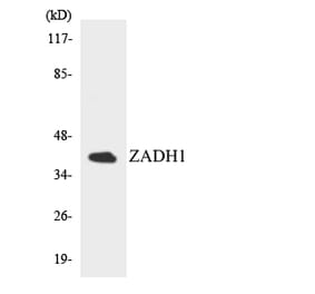 Western Blot - Anti-ZADH1 Antibody (R12-3685) - Antibodies.com