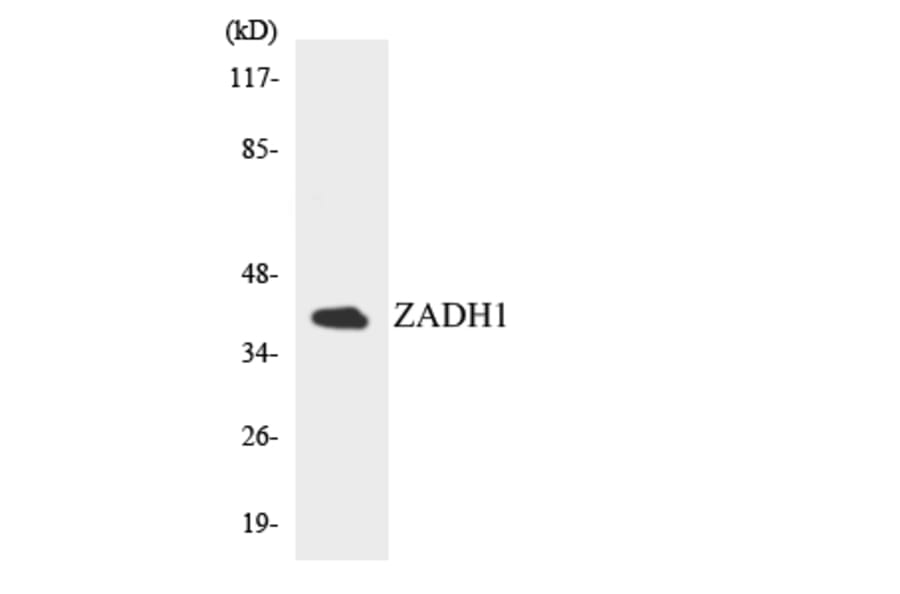 Western Blot - Anti-ZADH1 Antibody (R12-3685) - Antibodies.com