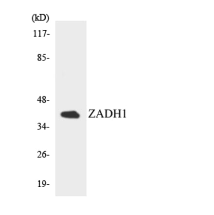 Western Blot - Anti-ZADH1 Antibody (R12-3685) - Antibodies.com