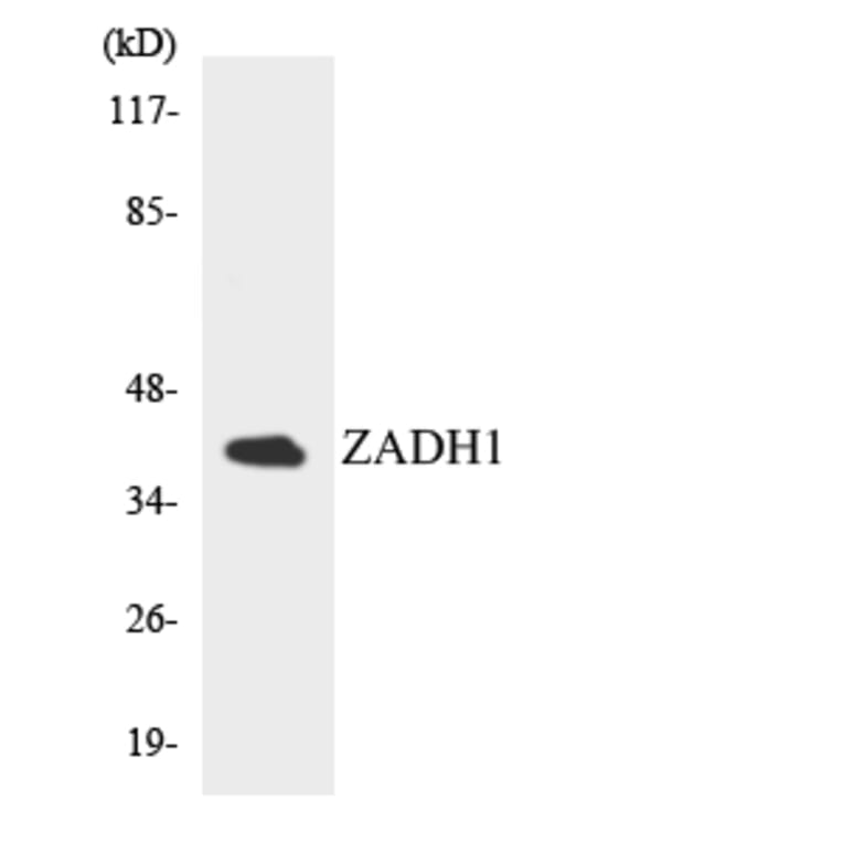 Western Blot - Anti-ZADH1 Antibody (R12-3685) - Antibodies.com