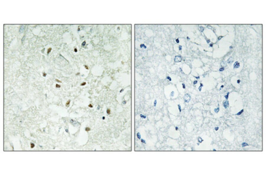 Immunohistochemistry - Anti-XRCC5 Antibody (C13063) - Antibodies.com