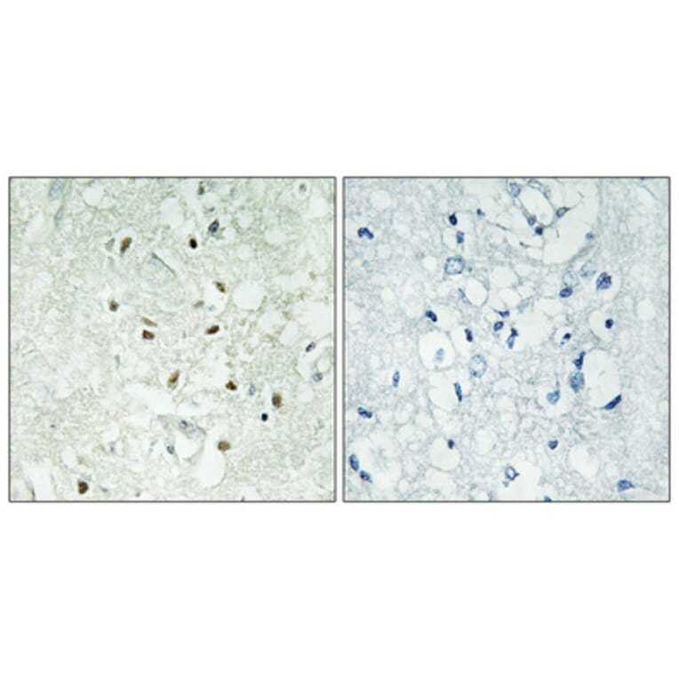 Immunohistochemistry - Anti-XRCC5 Antibody (C13063) - Antibodies.com