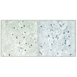 Immunohistochemistry - Anti-XRCC5 Antibody (C13063) - Antibodies.com