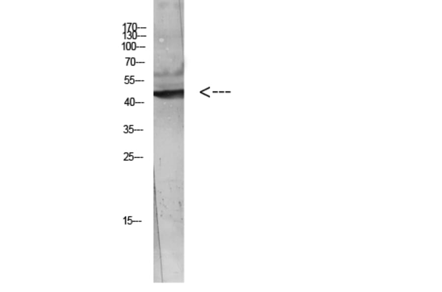 Western Blot - Anti-WISP3 Antibody (C30652) - Antibodies.com