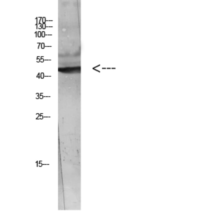 Western Blot - Anti-WISP3 Antibody (C30652) - Antibodies.com