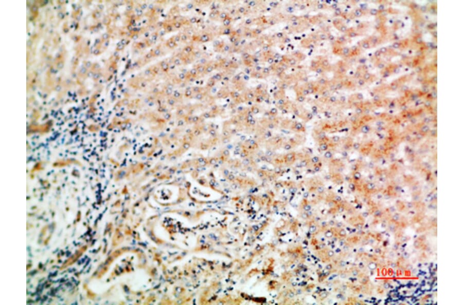 Immunohistochemistry - Anti-WISP3 Antibody (C30652) - Antibodies.com