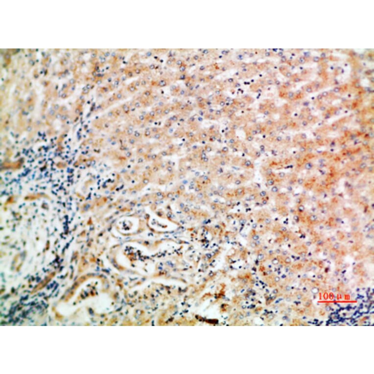 Immunohistochemistry - Anti-WISP3 Antibody (C30652) - Antibodies.com