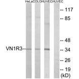 Western Blot - Anti-VN1R3 Antibody (G793) - Antibodies.com
