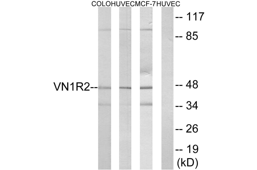 Western Blot - Anti-VN1R2 Antibody (G792) - Antibodies.com