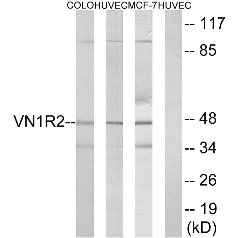 Western Blot - Anti-VN1R2 Antibody (G792) - Antibodies.com
