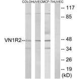 Western Blot - Anti-VN1R2 Antibody (G792) - Antibodies.com