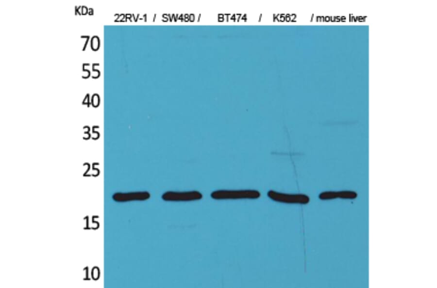 Western Blot - Anti-VEGFA Antibody (C30054) - Antibodies.com