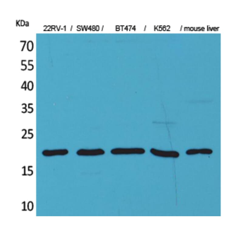 Western Blot - Anti-VEGFA Antibody (C30054) - Antibodies.com