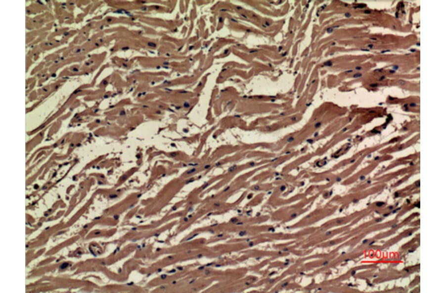 Immunohistochemistry - Anti-VEGFA Antibody (C30054) - Antibodies.com