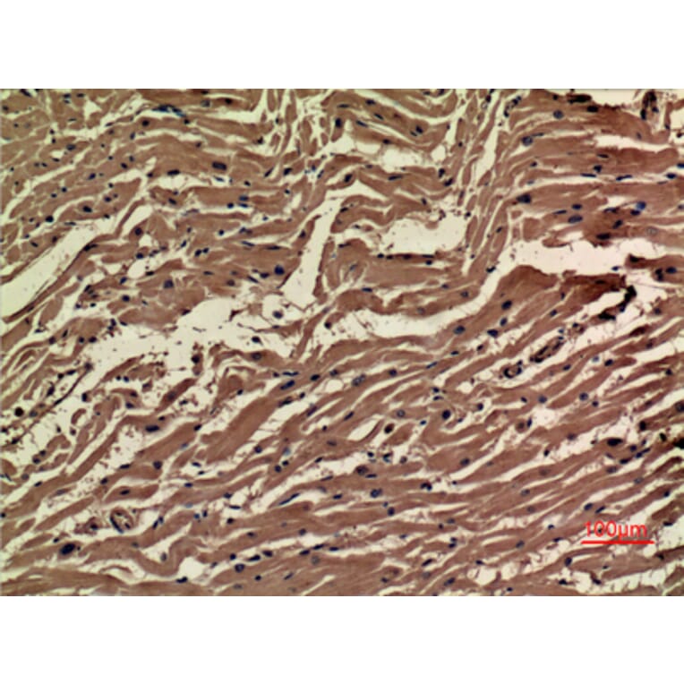 Immunohistochemistry - Anti-VEGFA Antibody (C30054) - Antibodies.com