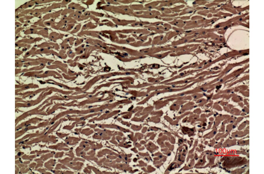 Immunohistochemistry - Anti-VEGFA Antibody (C30054) - Antibodies.com