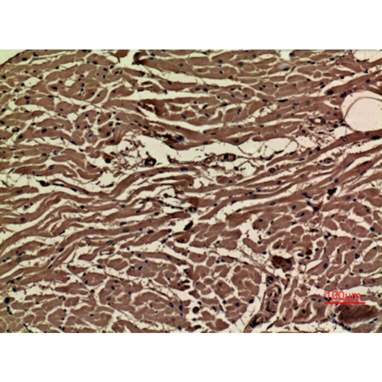 Immunohistochemistry - Anti-VEGFA Antibody (C30054) - Antibodies.com