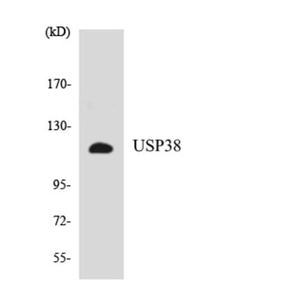 Western Blot - Anti-USP38 Antibody (R12-3670) - Antibodies.com