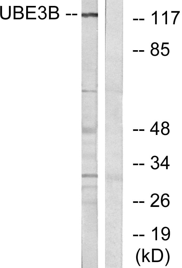 Western blot analysis of lysates from Jurkat cells using Anti-UBE3B Antibody. The right hand lane represents a negative control, where the antibody is blocked by the immunising peptide.