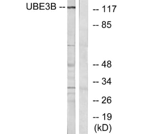 Western Blot - Anti-UBE3B Antibody (C19455) - Antibodies.com