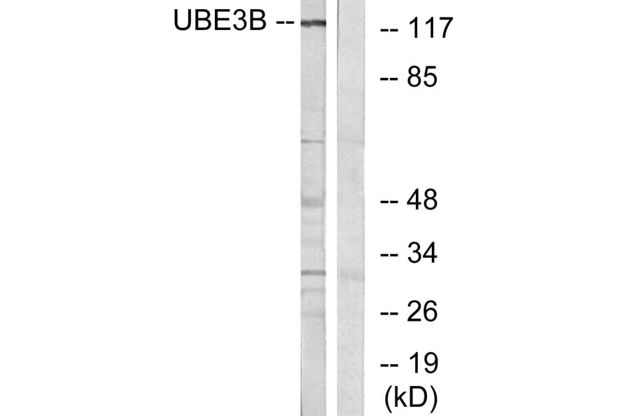 Western Blot - Anti-UBE3B Antibody (C19455) - Antibodies.com