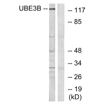 Western Blot - Anti-UBE3B Antibody (C19455) - Antibodies.com