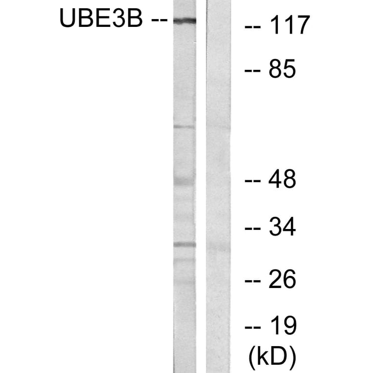 Western Blot - Anti-UBE3B Antibody (C19455) - Antibodies.com