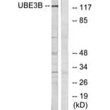Western Blot - Anti-UBE3B Antibody (C19455) - Antibodies.com