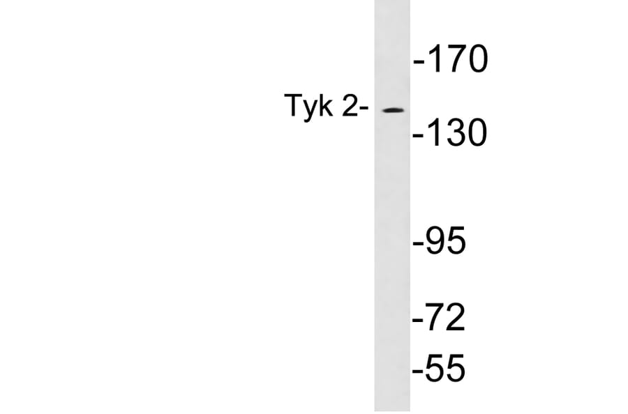 Western Blot - Anti-Tyk 2 Antibody (R12-2399) - Antibodies.com