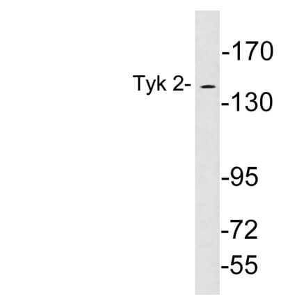 Western Blot - Anti-Tyk 2 Antibody (R12-2399) - Antibodies.com