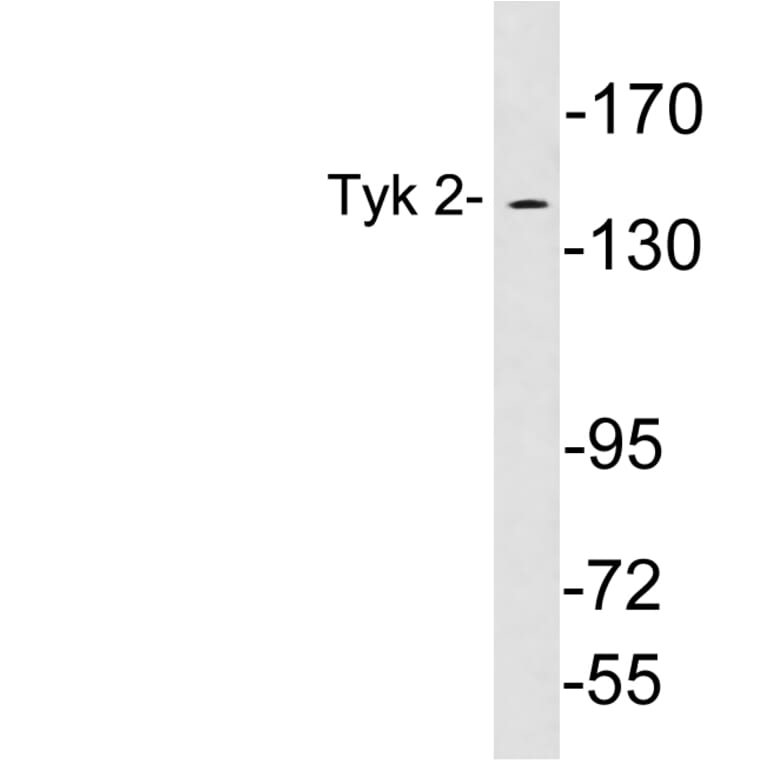 Western Blot - Anti-Tyk 2 Antibody (R12-2399) - Antibodies.com