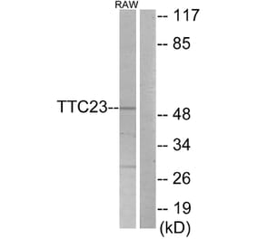 Western Blot - Anti-TTC23 Antibody (C11200) - Antibodies.com