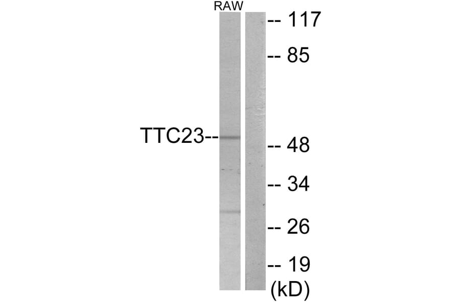 Western Blot - Anti-TTC23 Antibody (C11200) - Antibodies.com
