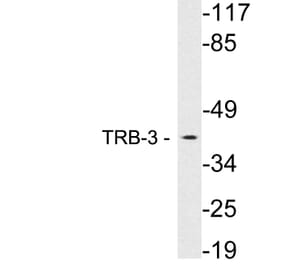 Western Blot - Anti-TRB-3 Antibody (R12-2387) - Antibodies.com