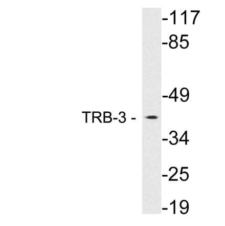 Western Blot - Anti-TRB-3 Antibody (R12-2387) - Antibodies.com