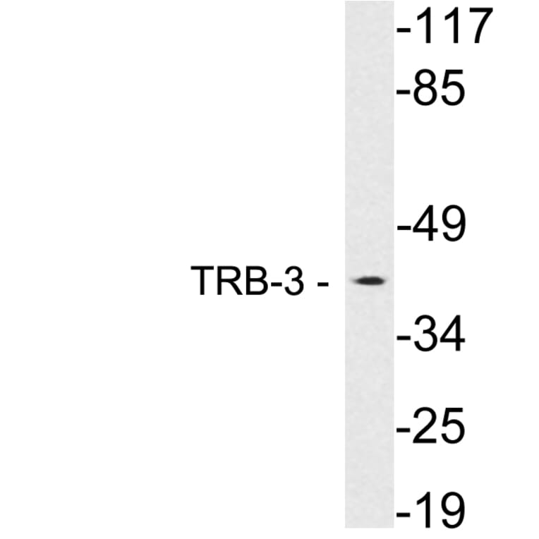 Western Blot - Anti-TRB-3 Antibody (R12-2387) - Antibodies.com