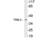 Western Blot - Anti-TRB-3 Antibody (R12-2387) - Antibodies.com