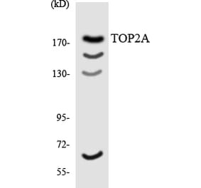 Western Blot - Anti-TOP2A Antibody (R12-3642) - Antibodies.com