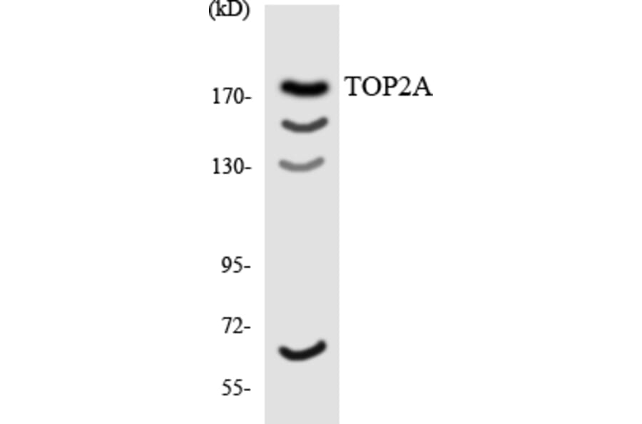 Western Blot - Anti-TOP2A Antibody (R12-3642) - Antibodies.com