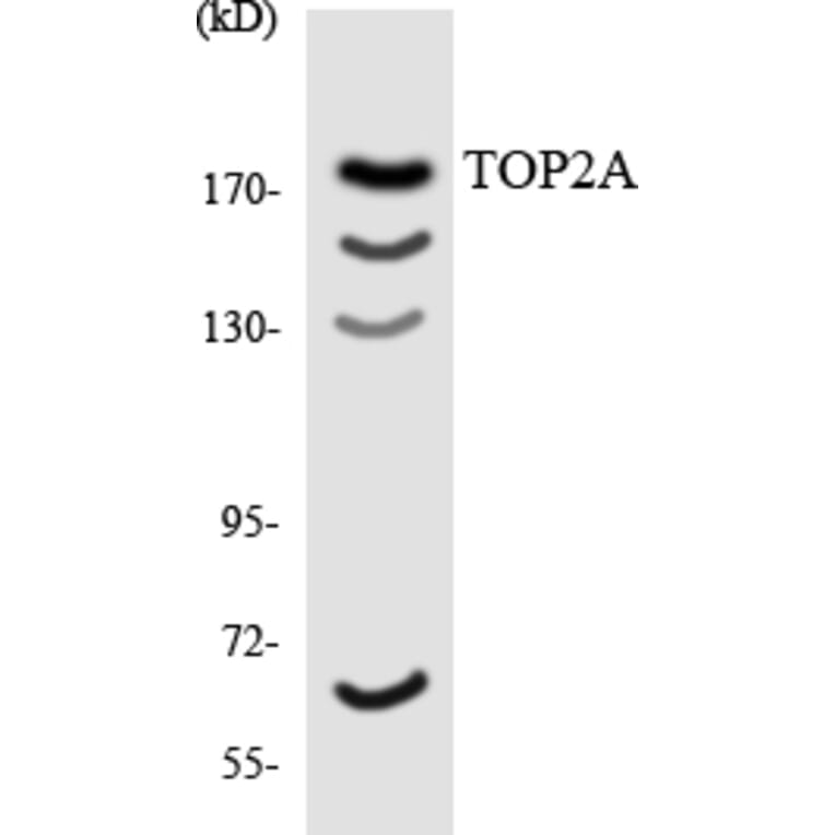 Western Blot - Anti-TOP2A Antibody (R12-3642) - Antibodies.com