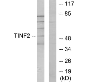 Western Blot - Anti-TINF2 Antibody (C11607) - Antibodies.com