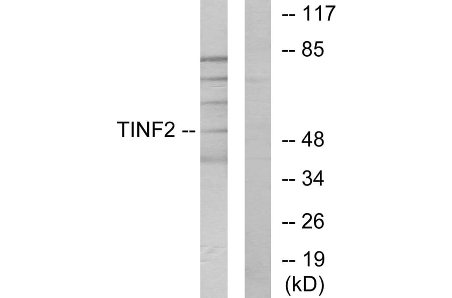 Western Blot - Anti-TINF2 Antibody (C11607) - Antibodies.com