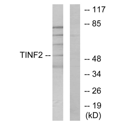 Western Blot - Anti-TINF2 Antibody (C11607) - Antibodies.com