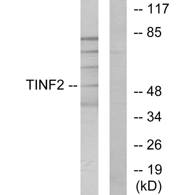 Western Blot - Anti-TINF2 Antibody (C11607) - Antibodies.com