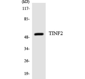 Western Blot - Anti-TINF2 Antibody (R12-3626) - Antibodies.com
