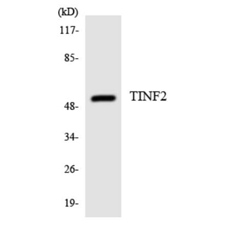 Western Blot - Anti-TINF2 Antibody (R12-3626) - Antibodies.com