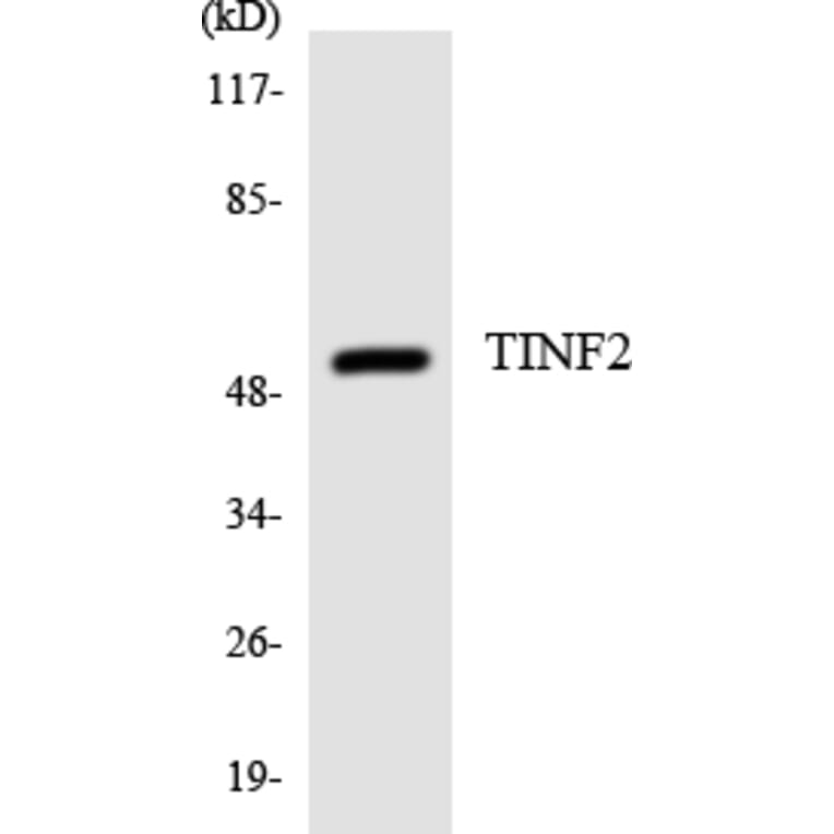 Western Blot - Anti-TINF2 Antibody (R12-3626) - Antibodies.com