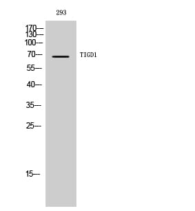 Western blot analysis of 293 cells using Anti-TIGD1 Antibody.