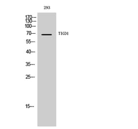 Western Blot - Anti-TIGD1 Antibody (C19116) - Antibodies.com